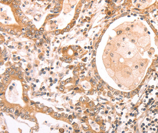 Anti-Human/Mouse/Rat ABCF1 Antibody - ABMIUM