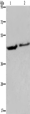Anti-Human/Mouse/Rat EIF3H Antibody - ABMIUM