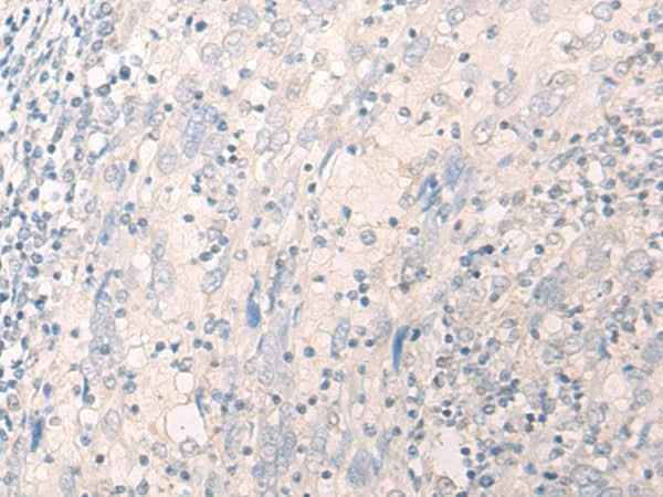 Anti-Human LILRA2 Antibody