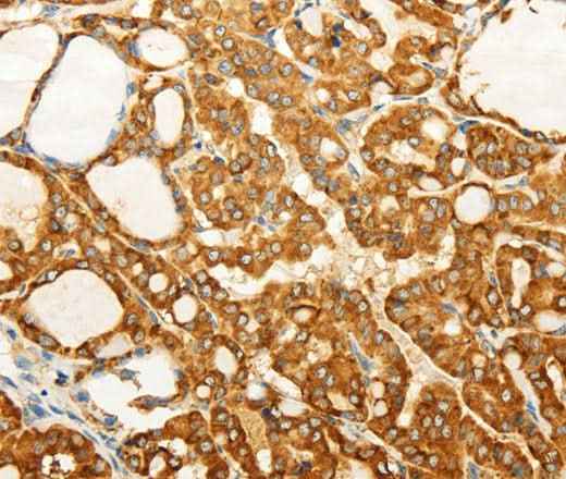 Anti-Human/Mouse FZD6 Antibody