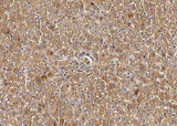 Anti-Rat TF Antibody [A1110] - ABMIUM