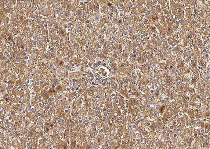 Anti-Rat TF Antibody [A1110] - ABMIUM