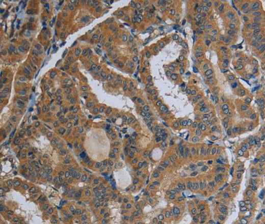 Anti-Human/Mouse/Rat FAAH Antibody