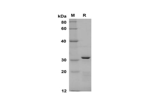 SDS-PAGE analysis of Human CD150 proteins, 2 μg/lane of Recombinant Human CD150 proteins was resolved with SDS-PAGE under reducing conditions, showing bands at 31 kDa.