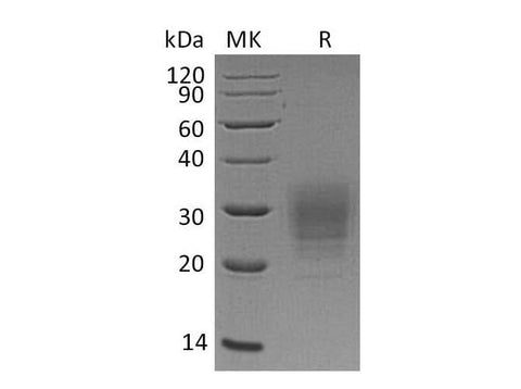Recombinant Human VSTM1 Protein (His Tag) - ABMIUM