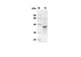 SDS-PAGE analysis of Human CCL3 proteins, 2 μg/lane of Recombinant Human CCL3 proteins was resolved with an SDS-PAGE under reducing conditions, showing bands at 32.1 kDa.