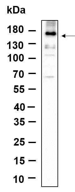 Anti-Human/Mouse/Rat EGFR Antibody [B887] - ABMIUM