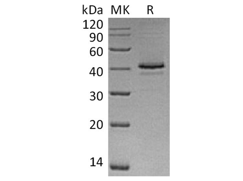 Recombinant Human CAMK1/CaMKI-alpha Protein (His Tag) - ABMIUM