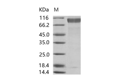 Recombinant EBOV (subtype Sudan, strain Gulu) GP1 / Glycoprotein Protein (His Tag) - ABMIUM