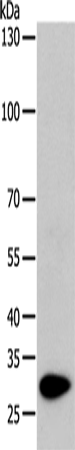 Anti-Human/Mouse/Rat TPM1 Antibody - ABMIUM