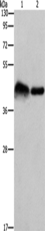 Anti-Human/Mouse/Rat CRELD1 Antibody - ABMIUM