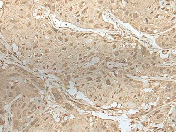 Anti-Human/Mouse/Rat ZBTB18 Antibody