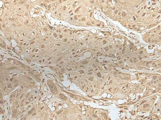 Anti-Human/Mouse/Rat ZBTB18 Antibody