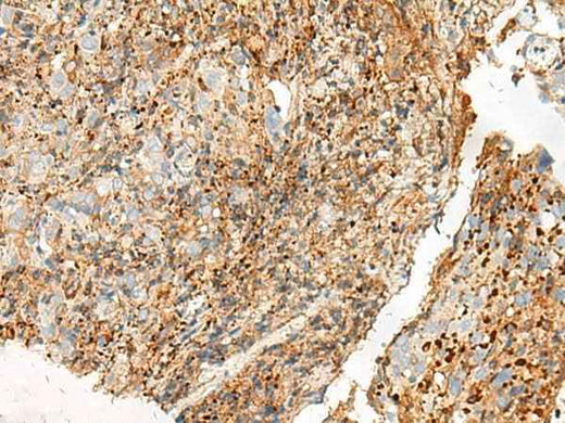 Anti-Human/Mouse/Rat GPR27 Antibody