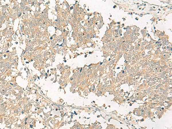 Anti-Human/Mouse GPR161 Antibody