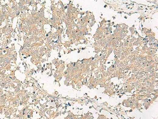 Anti-Human/Mouse GPR161 Antibody