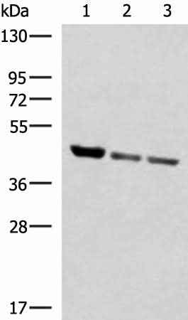 Anti-Human/Mouse/Rat SCCPDH Antibody
