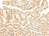 Anti-Human BICRA Antibody - ABMIUM