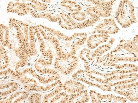 Anti-Human BICRA Antibody - ABMIUM