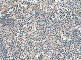 Immunohistochemistry of paraffin-embedded Human tonsil tissue using IP6K2 Polyclonal Antibody at dilution of 1:140(×200)