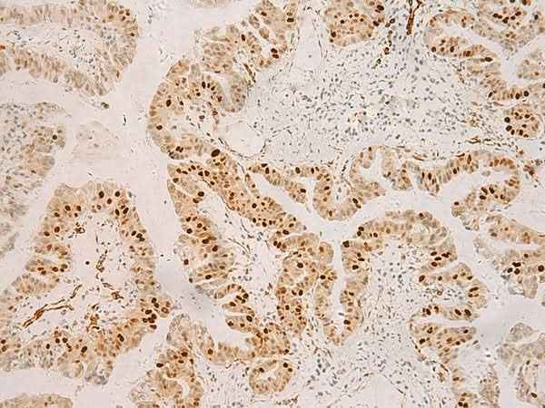 Anti-Human/Mouse RFX6 Antibody