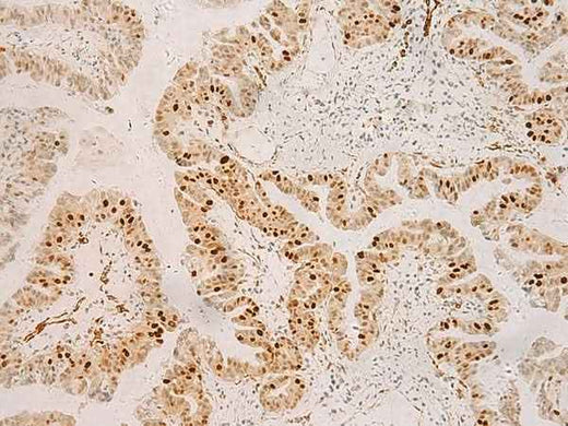 Anti-Human/Mouse RFX6 Antibody