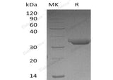 Recombinant Human Proteinase 3/PRTN3 Protein (His Tag) - ABMIUM