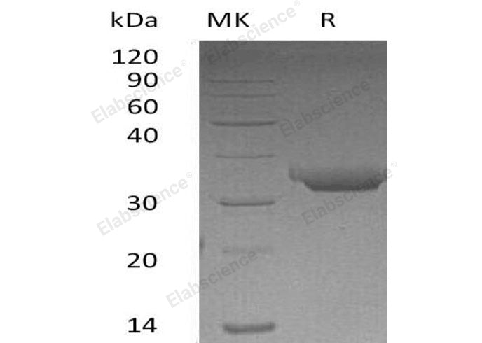 Recombinant Human Proteinase 3/PRTN3 Protein (His Tag) - ABMIUM