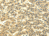 Anti-Human/Mouse/Rat MSI1 Antibody - ABMIUM