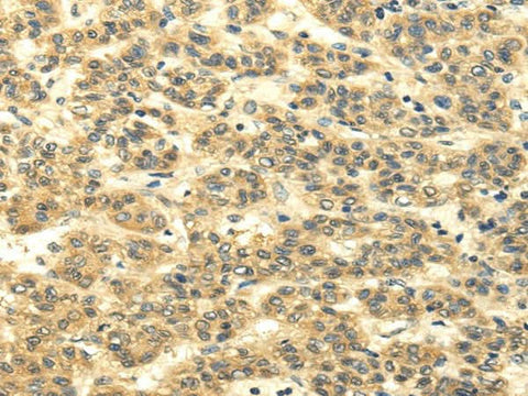 Anti-Human/Mouse/Rat MSI1 Antibody - ABMIUM