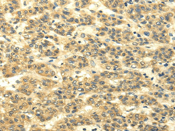 Anti-Human/Mouse/Rat MSI1 Antibody - ABMIUM