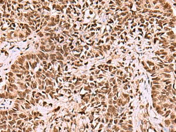 Anti-Human/Mouse LDB1 Antibody