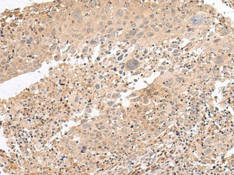 Anti-Human PATJ Antibody - ABMIUM