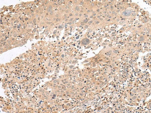 Anti-Human PATJ Antibody - ABMIUM