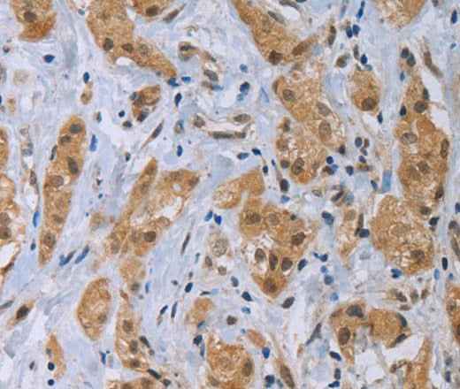 Anti-Human CLEC1A Antibody
