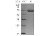 Recombinant Human Osteoprotegerin/TNFRSF11B Protein (His Tag) - ABMIUM