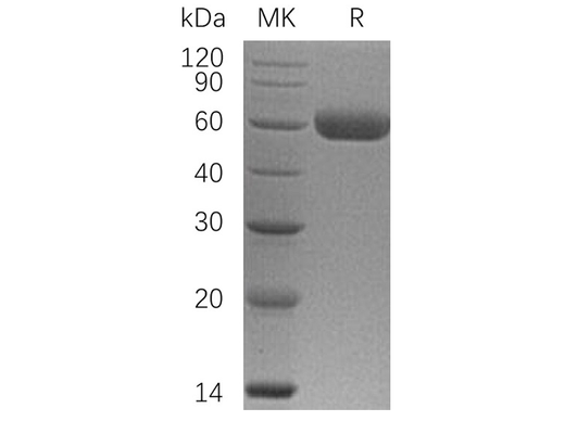 Recombinant Human Osteoprotegerin/TNFRSF11B Protein (His Tag) - ABMIUM