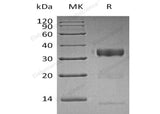 Recombinant Human Kallikrein 10/KLK10 Protein (His Tag) - ABMIUM