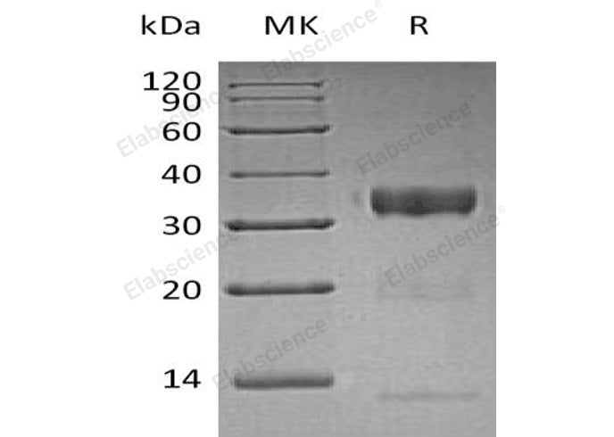 Recombinant Human Kallikrein 10/KLK10 Protein (His Tag) - ABMIUM
