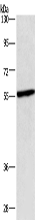 Anti-Human/Rat CEP55 Antibody - ABMIUM