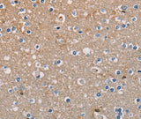 Anti-Human/Mouse AMBRA1 Antibody - ABMIUM