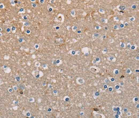 Anti-Human/Mouse AMBRA1 Antibody