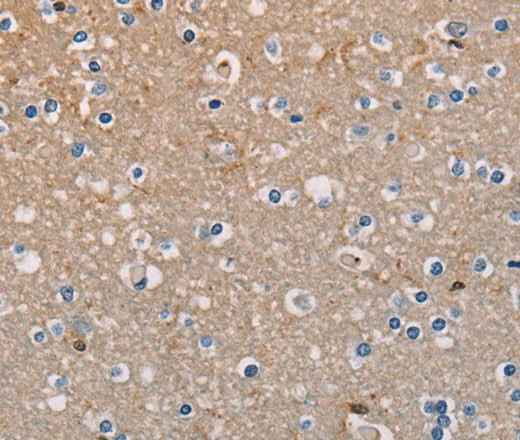 Anti-Human/Mouse AMBRA1 Antibody
