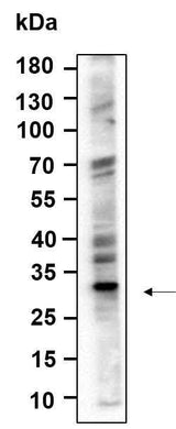 Anti-Human/Mouse/Rat ALKBH2 Antibody [B987]