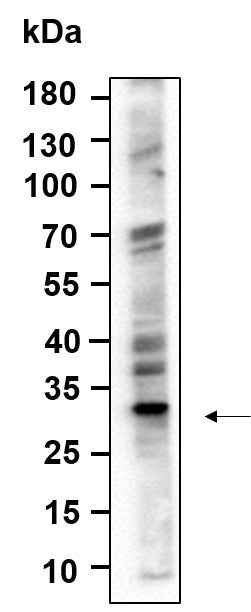 Anti-Human/Mouse/Rat ALKBH2 Antibody [B987] - ABMIUM