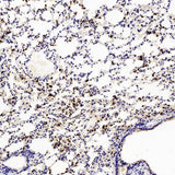 Immunohistochemistry analysis of paraffin-embedded mouse Inflammatory lung using Ly6g Polyclonal Antibody at dilution of 1:200.