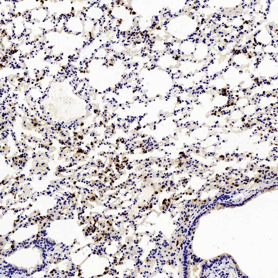 Immunohistochemistry analysis of paraffin-embedded mouse Inflammatory lung using Ly6g Polyclonal Antibody at dilution of 1:200.