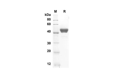 SDS-PAGE analysis of Rat GM-CSF proteins, 2 μg/lane of Recombinant Rat GM-CSF proteins was resolved with an SDS-PAGE under reducing conditions, showing bands at 40.7 kDa.