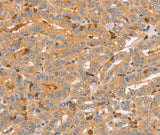 Anti-Human CCL16 Antibody - ABMIUM