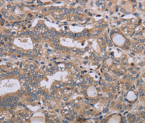 Anti-Human NAA25 Antibody - ABMIUM